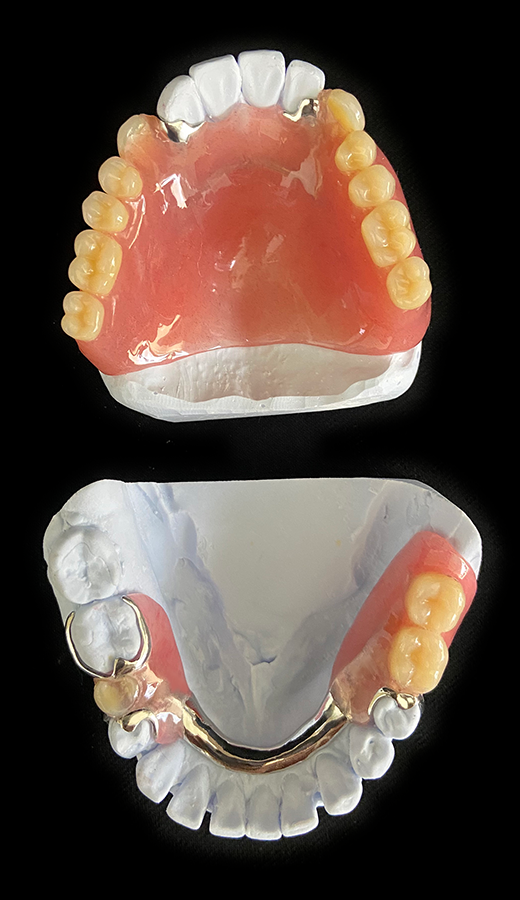 売り切り御免！】 歯科技工 総義歯の研磨面形態 デンチャーカントゥア 